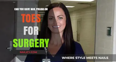 Nail Polish on Toes Before Surgery: What You Need to Know