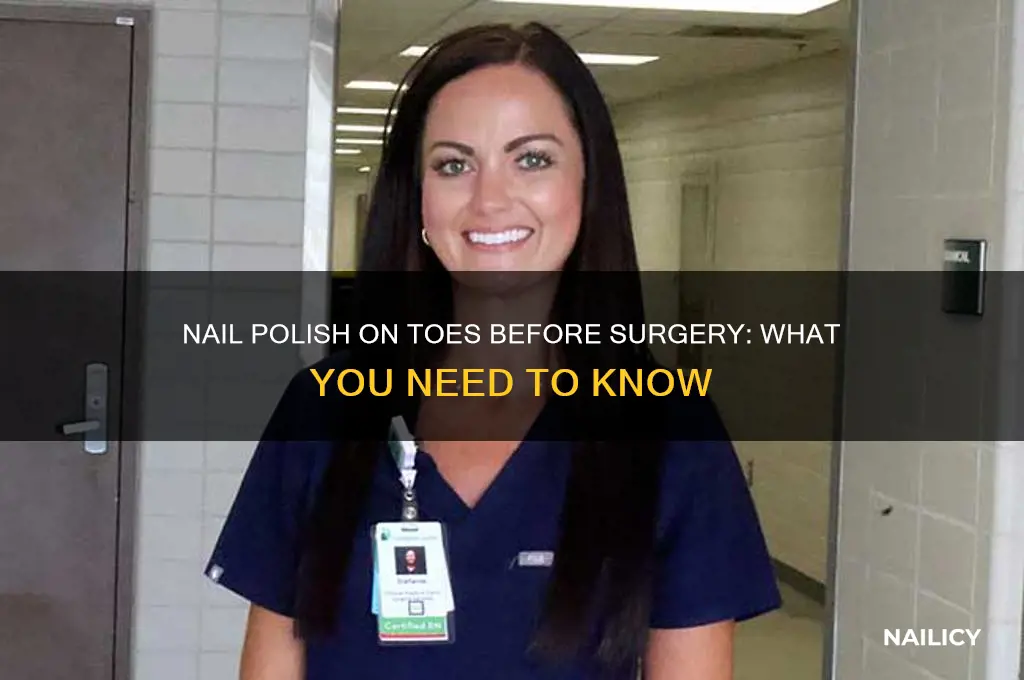 can you have nail polish on toes for surgery