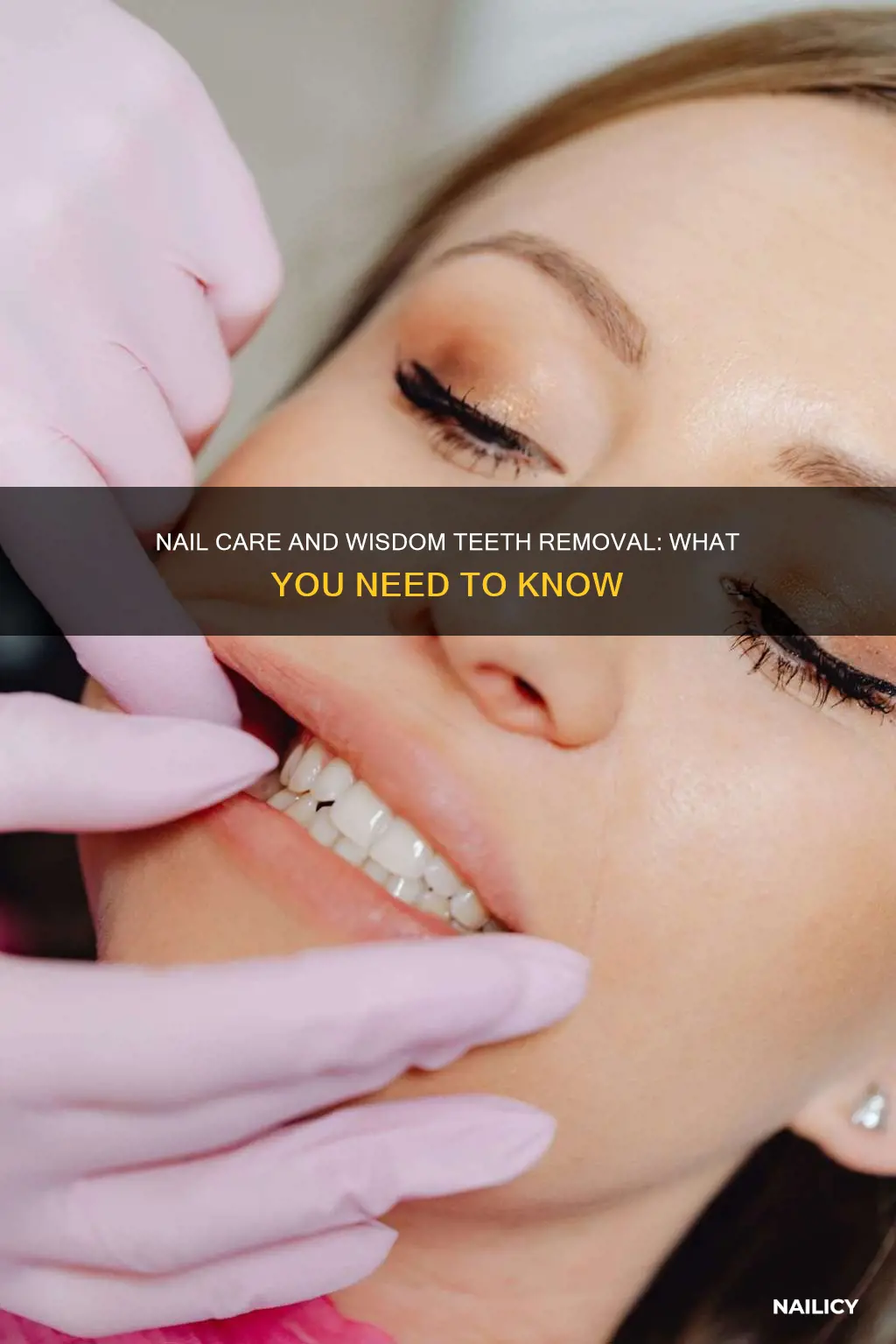can you have your nails done for wisdom teeth removal