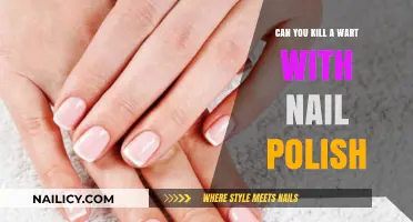 Can Nail Polish Kill Warts? Uncovering the Truth Behind the Myth