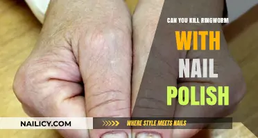 Can Nail Polish Kill Ringworm? Debunking Myths and Finding Solutions