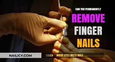 How to Remove Fingernails: Permanent Solutions