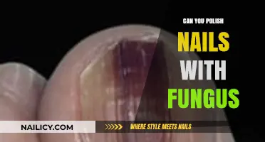 Polishing Nails with Fungus: Risks, Safety Tips, and Healthy Alternatives