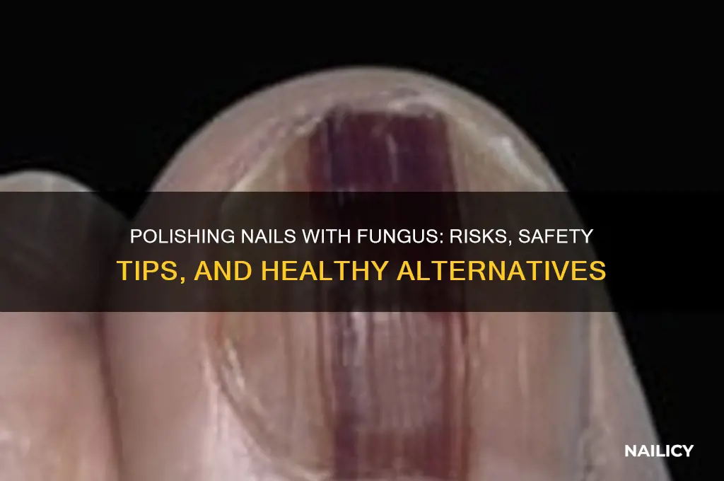 can you polish nails with fungus