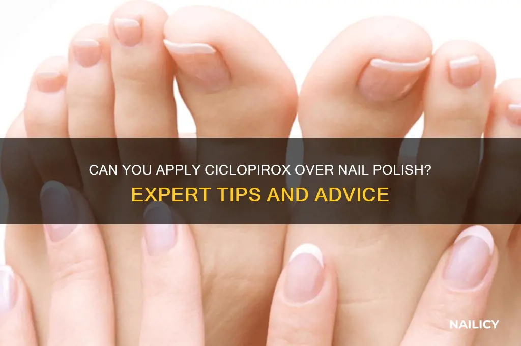 can you put ciclopirox over nail polish