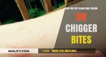 Clear Nail Polish on Chigger Bites: Effective Remedy or Myth?