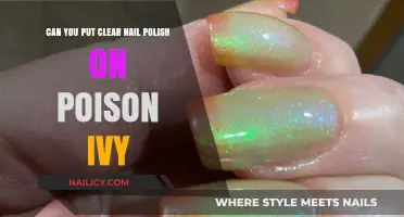 Clear Nail Polish on Poison Ivy: Does It Work or Worsen?