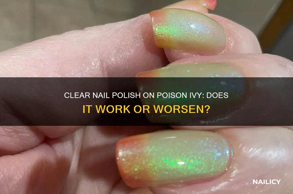 can you put clear nail polish on poison ivy