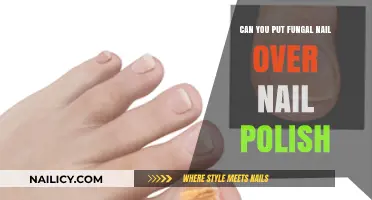 Fungal Nail Infections and Nail Polish: Safe to Combine?