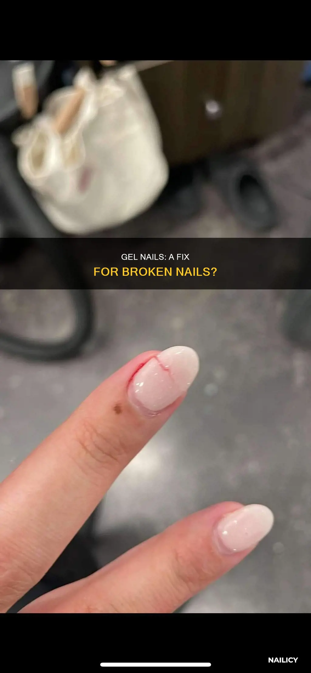 can you put gel nails on broken nails