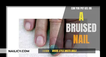 Gel on Bruised Nails: What You Need to Know