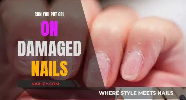 Gel on Damaged Nails: What You Need to Know