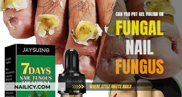 Gel Polish on Fungal Nails: Is It Safe?