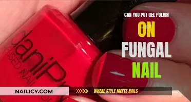 Gel Polish on Fungal Nails: Is It Safe?