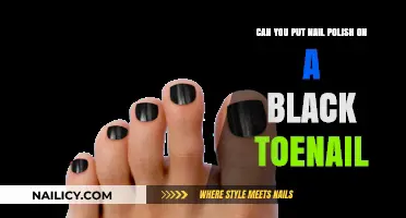 Can You Safely Apply Nail Polish on a Black Toenail?