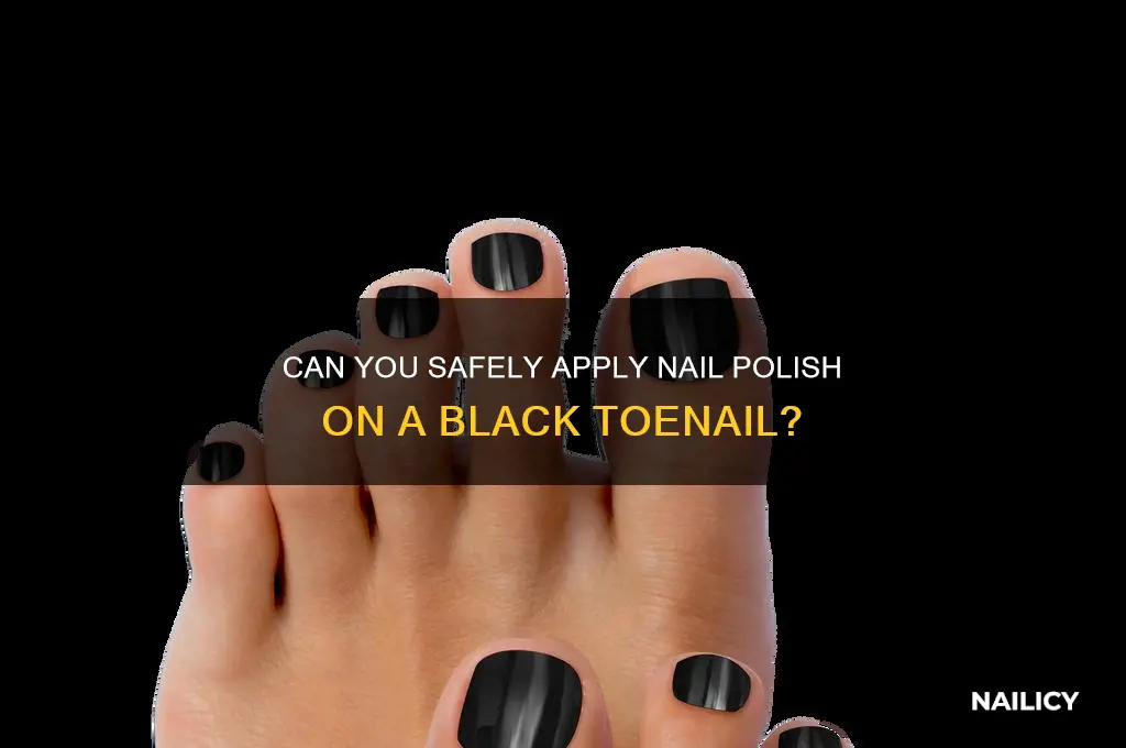 can you put nail polish on a black toenail