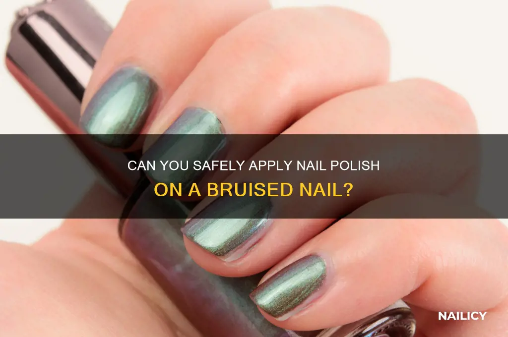 can you put nail polish on a bruised nail
