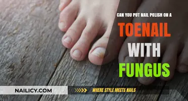 Toenail Fungus and Nail Polish: Safe to Apply or Risky?