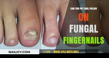Nail Polish on Fungal Fingernails: Safe or Risky Choice?