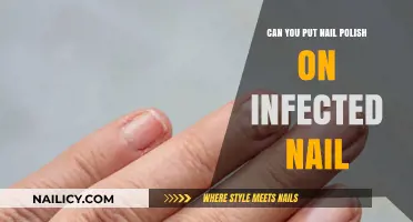 Infected Nails and Polish: Safe Application Tips and Risks