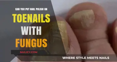 Toenail Fungus and Polish: Safe to Apply or Risky Choice?