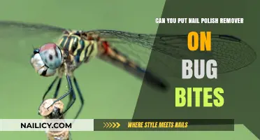 How to Use Nail Polish Remover for Bug Bites