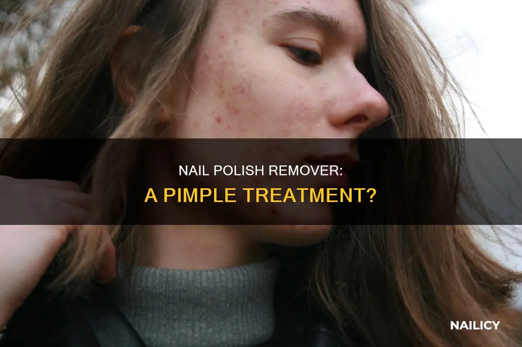 can you put nail polish remover on pimples