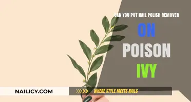 How to Treat Poison Ivy with Nail Polish Remover