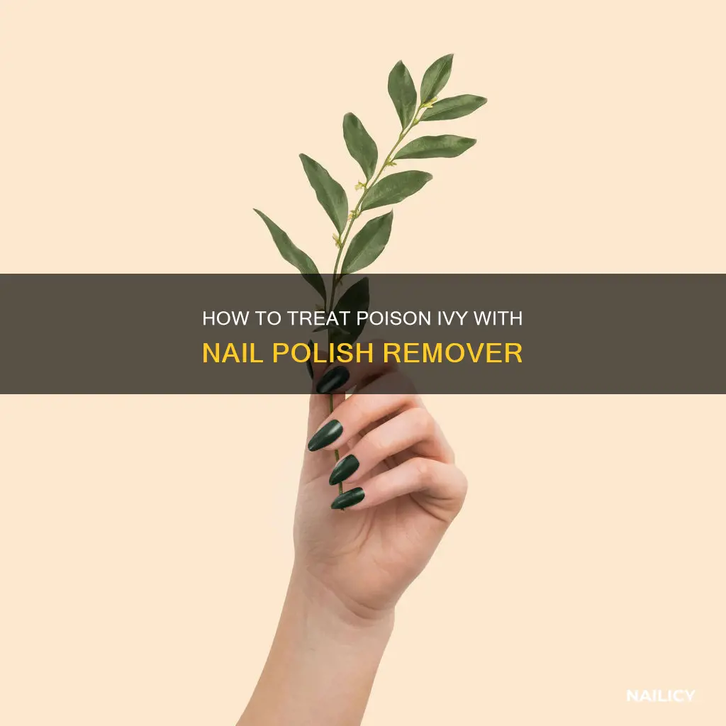 can you put nail polish remover on poison ivy