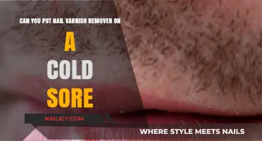 Nail Varnish Remover: Cold Sore Treatment or Myth?