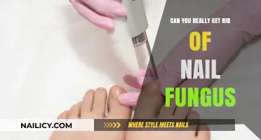 Banishing Nail Fungus: Myths, Facts, and Effective Treatments