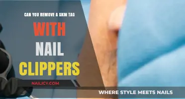 Trimming Skin Tags: Safe to Use Nail Clippers?