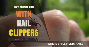 How to Remove a Tick: Nail Clippers vs Tweezers