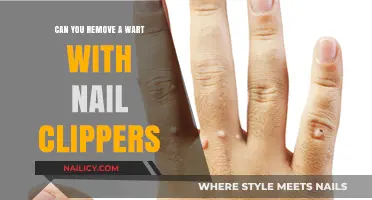 How to Remove Warts with Nail Clippers at Home