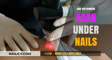 How to Remove Scars Under Nails?