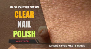 Clear Nail Polish: An Effective Skin Tag Remedy?