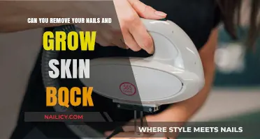 How to Remove Nails and Regrow Skin