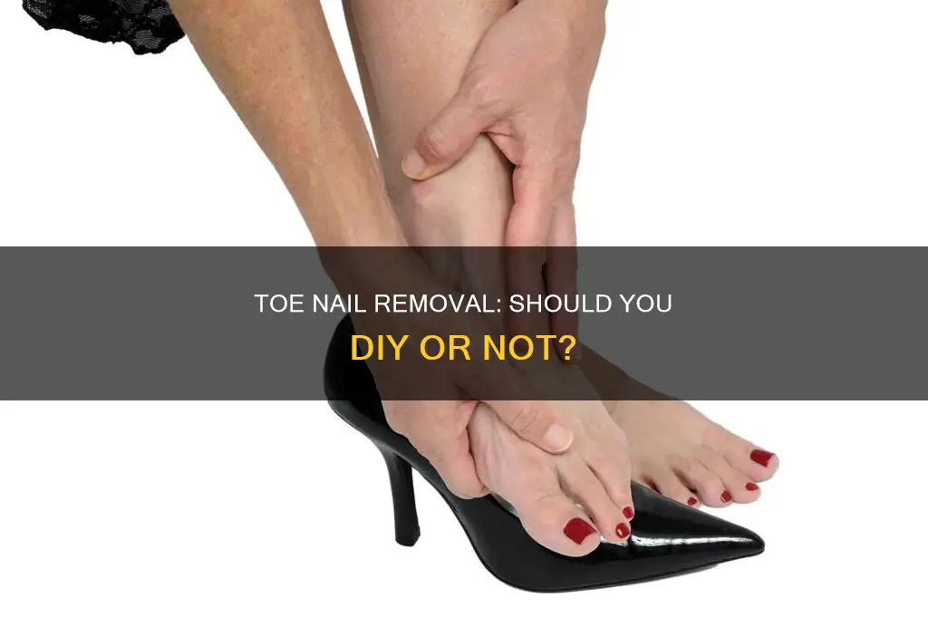 can you remove your own toe nail