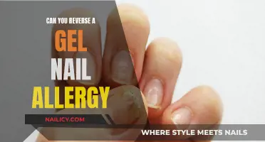 Gel Nail Allergy: Reversing the Reaction