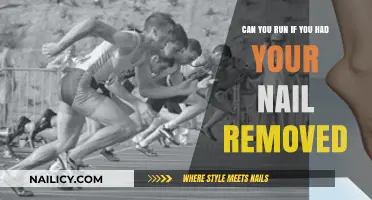 Running Post-Ingrown Toenail Surgery: Is It Possible?