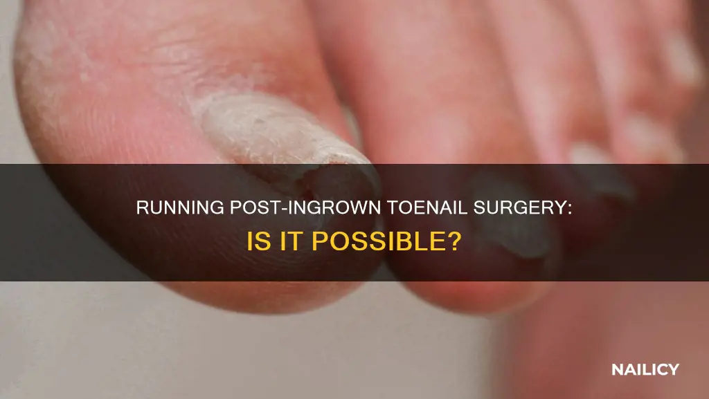 can you run if you had your nail removed