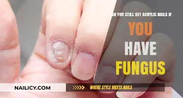Fungal Infection and Acrylic Nails: What You Need to Know