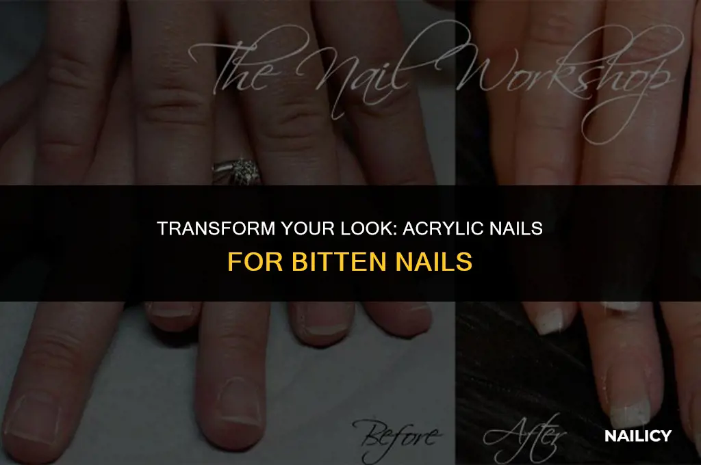 can you still get acrylics with bitten nails