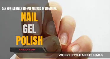 Fingernail Gel Polish: Can It Cause Sudden Allergies?