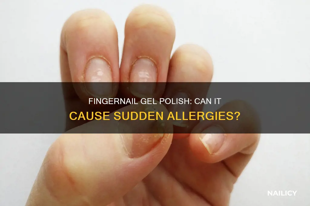 can you suddenly become allergic to fingernail nail gel polish