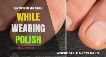 Treating Nail Fungus Under Polish: Effective Solutions and Tips