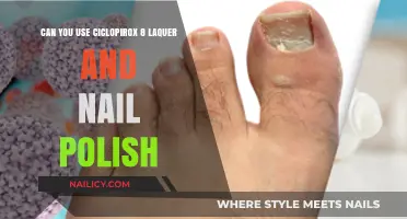 Ciclopirox 8% Lacquer and Nail Polish: Compatibility Explained