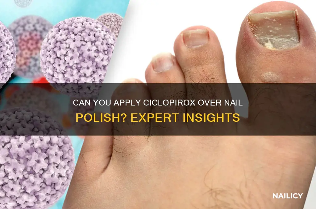 can you use ciclopirox over nail polish