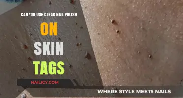 Using Clear Nail Polish on Skin Tags: Safe or Risky?