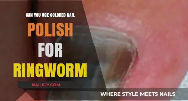 Colored Nail Polish for Ringworm: Safe, Effective, or Harmful?